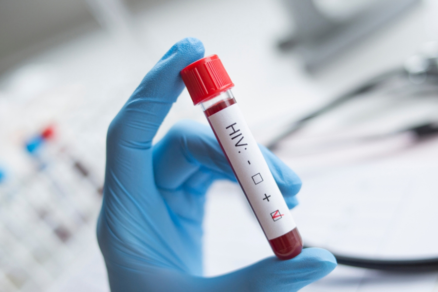 नेपालमा ३४ हजारमध्ये ८ हजार एचआईभी सङ्क्रमित उपचार बाहिर