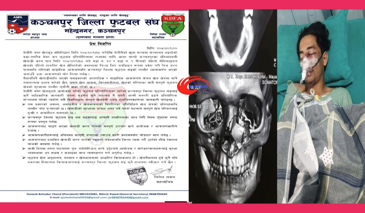 राष्ट्रका होनहार खेलाडी करन पालमाथि भएको कुटपिटको घोर भत्सर्ना